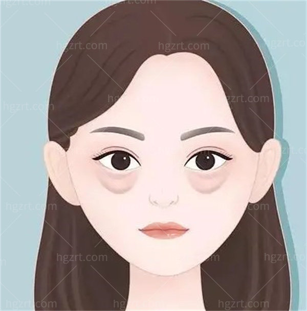 广州新市游鹏飞祛眼袋技术好不好