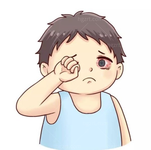 散光3.jpg
