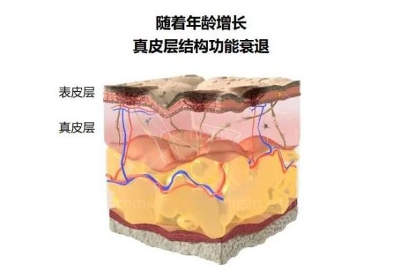 打除皱后注意事项有什么