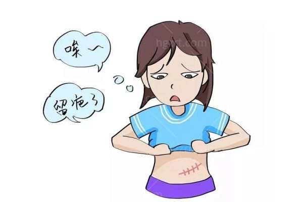 疤痕增生手术切除多少钱