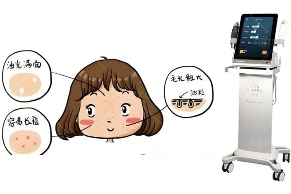 解决暗沉肌肤常见的轻医美项目有哪些