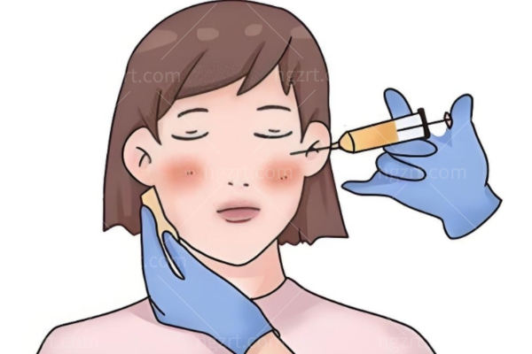 玻尿酸不同的部位注射怎么选择呢?稳准塑形抗衰急救可逆无担心