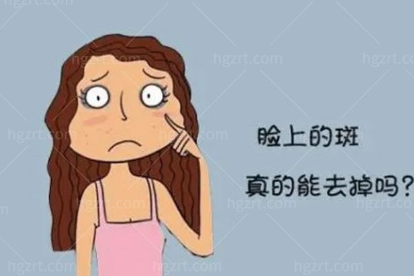 成都激光祛斑多少钱