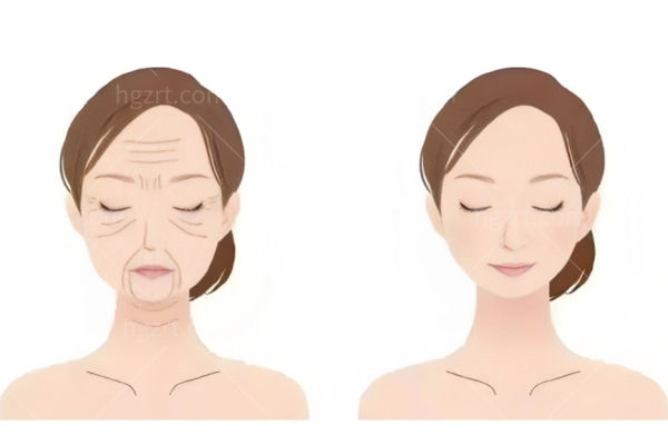 轻薄针真的能把生长因子打掉吗