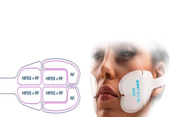 EMFACE美菲斯怎么样