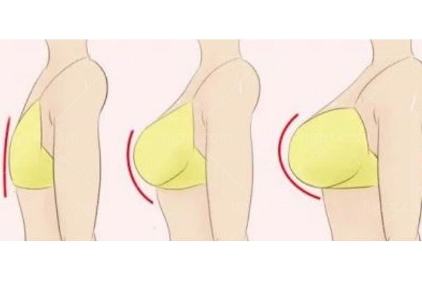 深圳缩胸手术好的医院排名！强大医生+靠谱技术，选对医院是关键！