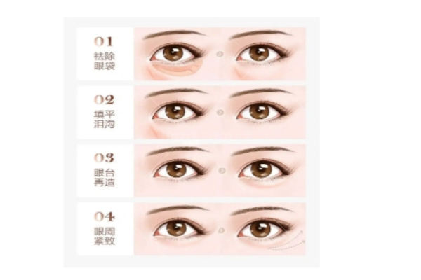 兰州时光眼整形的医生技术优势