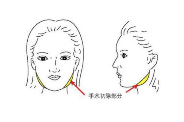 重庆星荣轮廓医生刘正茂和苟磊怎么样