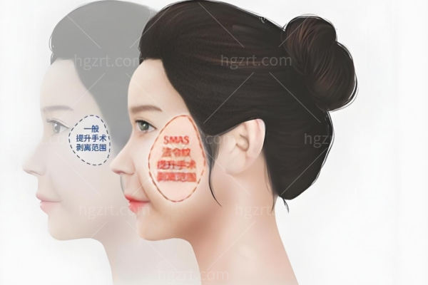 眼周筋膜提升哪里做的好?北京加减美/上海时光/广州中家医/深圳鹏程/成都素美技术牛