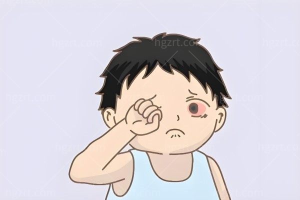 身边周围有人得红眼病，红眼病会不会传染给别人？
