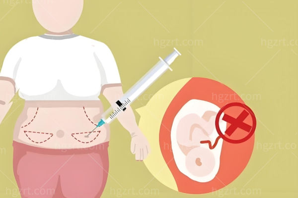 崔鑫医生腹壁整形怎么样?坐诊西安国医疤痕隐藏口碑稳身体紧致好评多