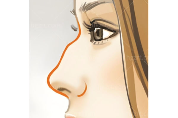 什么是G.E.B骨相原生美鼻术