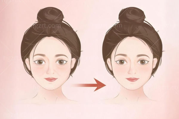 西安面部馒化修复正规医院排名 画美/国医/艺星/高一生馒化修复技术可靠优势多