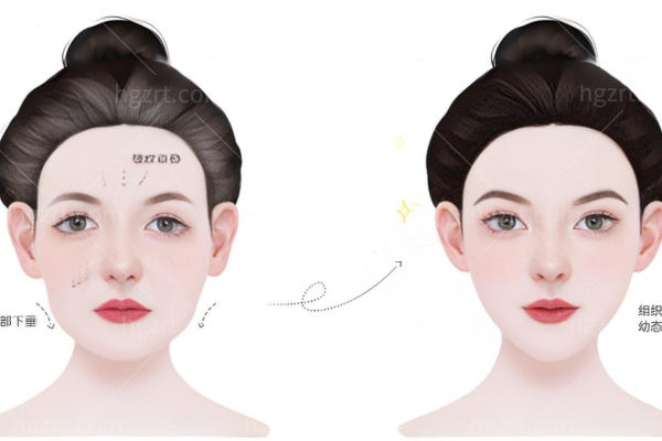 西安面部馒化修复正规医院排名 画美/国医/艺星/高一生馒化修复技术可靠优势多