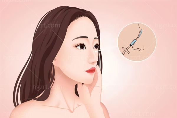 房志强做鼻子怎么样?隆鼻自然风妈生鼻技术可靠口碑好满意度高