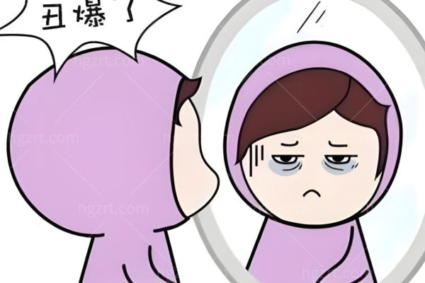 杭州谭章梅院长祛眼袋技术好吗?坐诊美莱祛眼袋微创经验多复原快创伤小好评多