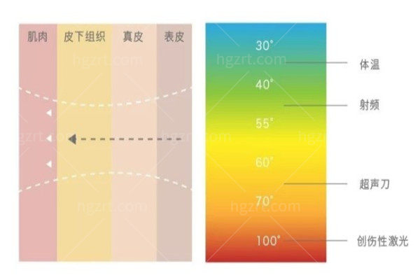 美菲斯+美版超声 刀怎么样