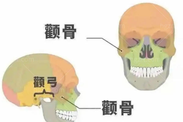 北京改脸型医生黄大勇做得好吗?专注颅颌面整形技术可靠切口小复原快