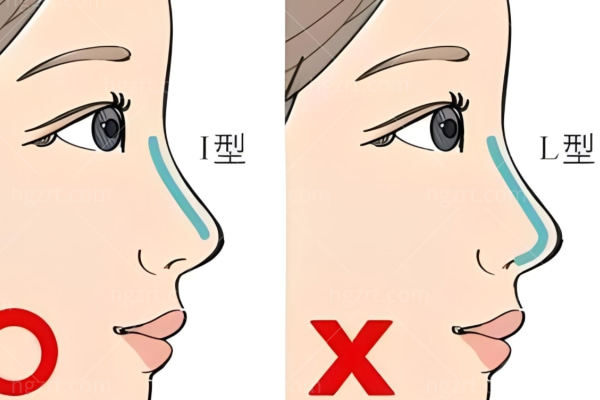 成都西区医院邓东伟做鼻子怎么样?擅长高难度鼻修复微创自然无假体感