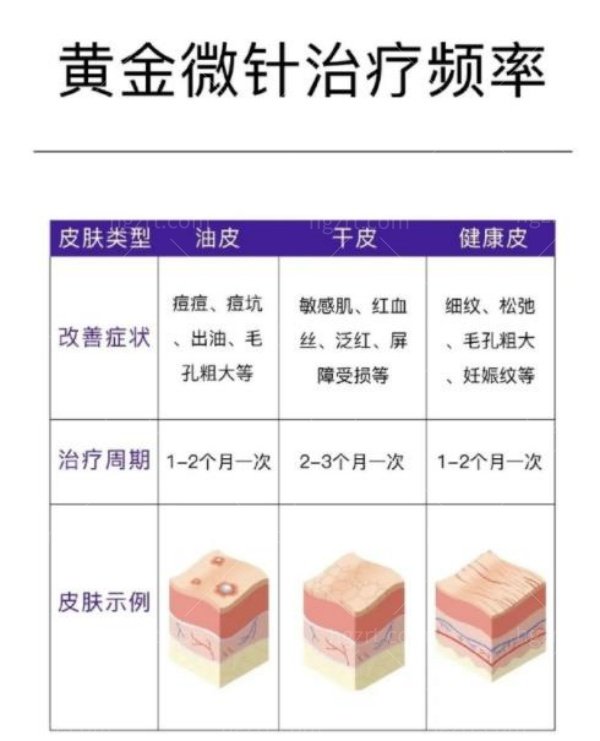 相控黄金微针多少钱