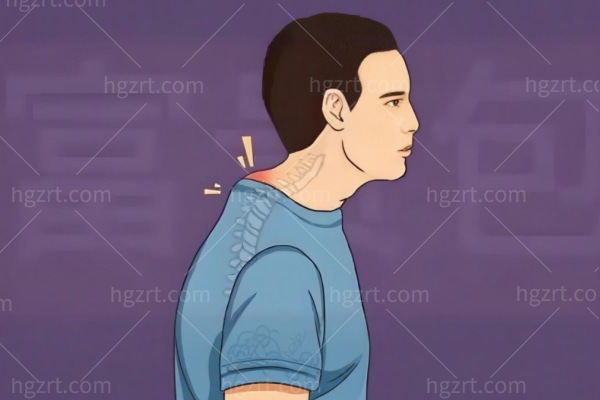 重庆哪家医院可以做富贵包手术?华美/军美/星荣/时光做富贵包微创技术强劲不踩雷