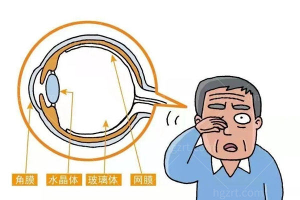 白内障晶体一只眼单焦一只眼多焦可以吗?需从日常生活/医生评估多角度分析