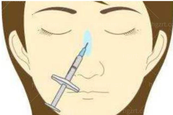 薇丽兰骨雕是什么材质?生物复合材料改善鼻子/下巴/法令纹/眉骨/鼻基底