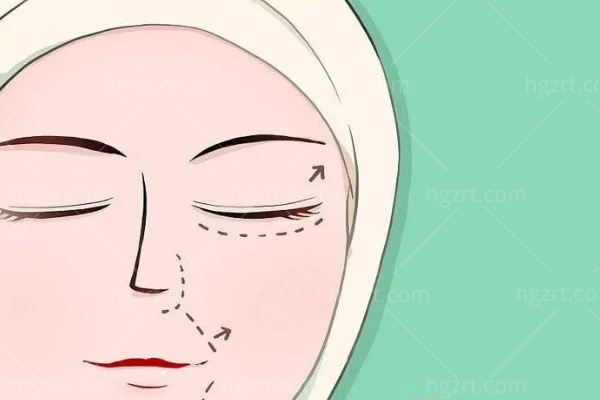 广州双眼皮修复医生排名 李光琴/陈贵宗/齐云香修复双眼皮技术牛价格亲民不踩雷