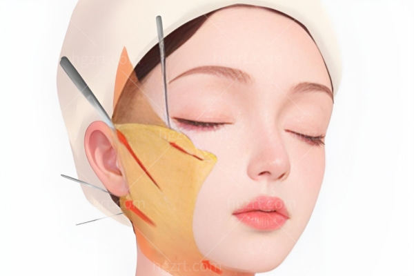 韩国cell the young皮肤科收费标准25版公布 光电/埋线提升/填充/黄金微针/水光价格一览表