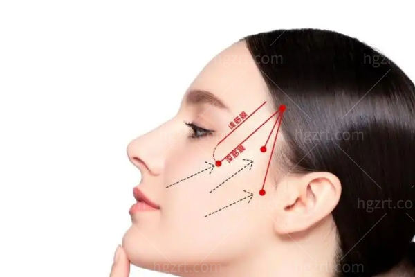 韩国cell the young皮肤科收费标准25版公布 光电/埋线提升/填充/黄金微针/水光价格一览表