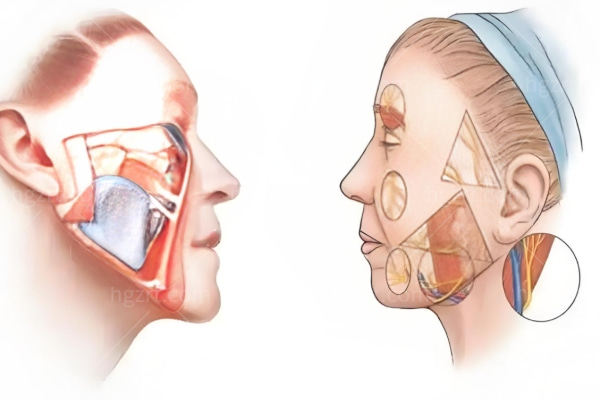韩国cell the young皮肤科收费标准25版公布 光电/埋线提升/填充/黄金微针/水光价格一览表