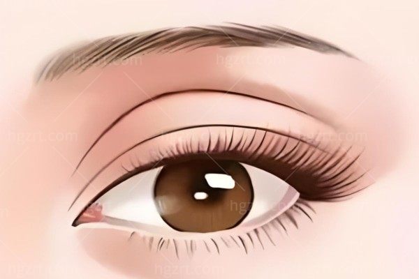 广州双眼皮修复医生排名 李光琴/陈贵宗/齐云香修复双眼皮厉害价格亲民不踩雷