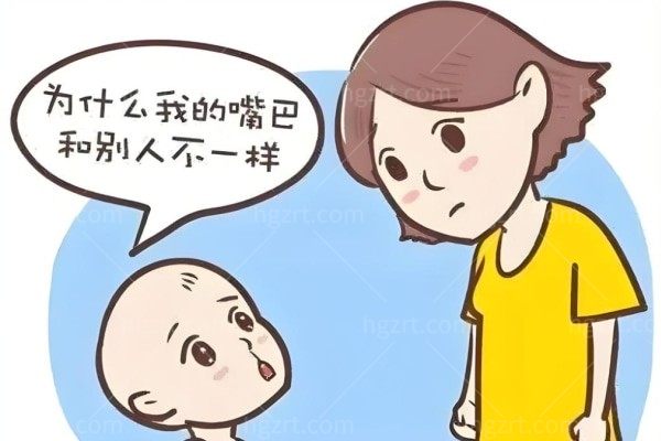 广州唇裂整形好的医院排名 高尚/广大/中家医做唇腭裂手术可靠稳居前列