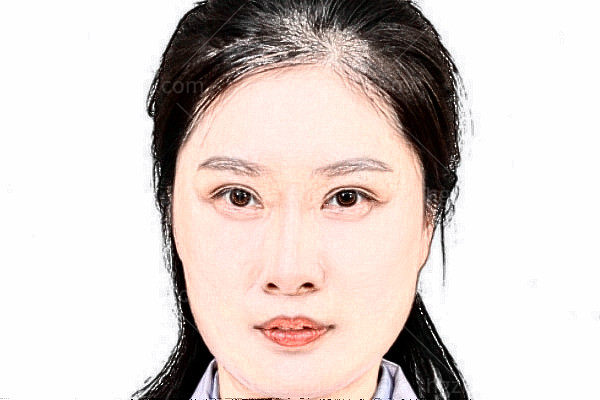 苏州眼耳鼻喉科医院眼科张彩霞医生