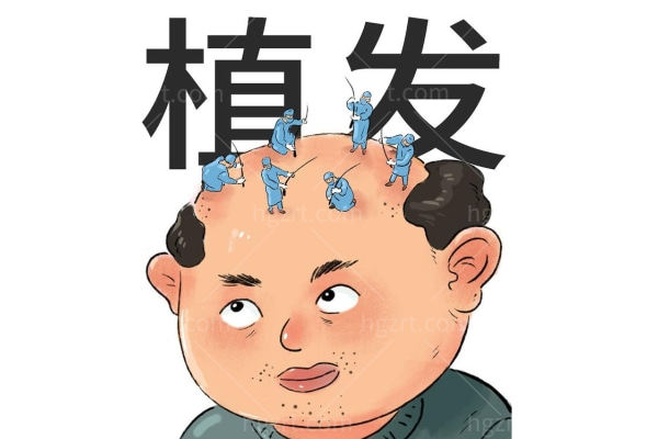 首瑞植发 5.1活动来袭 植发技术口碑实力强价格亲民实力医生坐诊