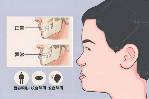 2025重庆肖林做正颌手术价格全解析:技术如何?坐诊医院在哪?对比朱乐林谁更好?