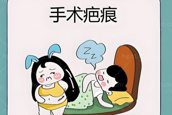 深圳祛疤有名的正规医院有哪些?技术强口碑好的医院盘点