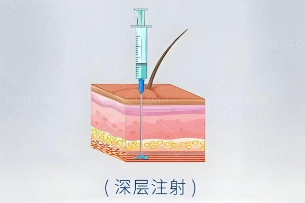 2025蒋铮铮收费标准曝光 技术稳准狠,注射不翻车附上价格表