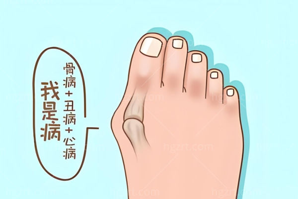 苏敬达和温建民谁腻害?从切口/复原/长期稳定性来看解决拇外翻困扰