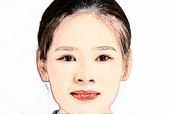 苏州眼耳鼻喉科医院眼科胡伟霞医生