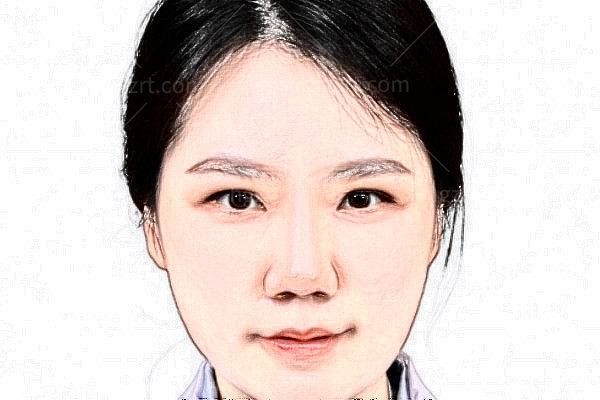 苏州眼耳鼻喉科医院眼科陈馨竹医生