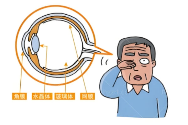 视神经减压手术危险吗?早发现早治疗危险能降低黄金手术时间是72h