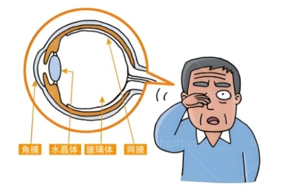 视神经减压手术危险吗?早发现早治疗危险能降低黄金手术时间是72h