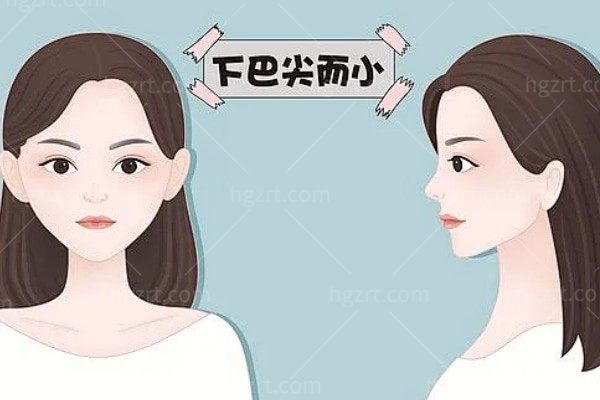 面部轮廓整形医院医生排名2025:北京圣嘉新/西安国医/广州韩妃稳居前三