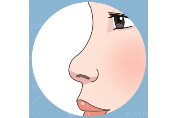 深圳李信锋做鼻子怎么样?风格自然堪比妈生鼻一文秒懂