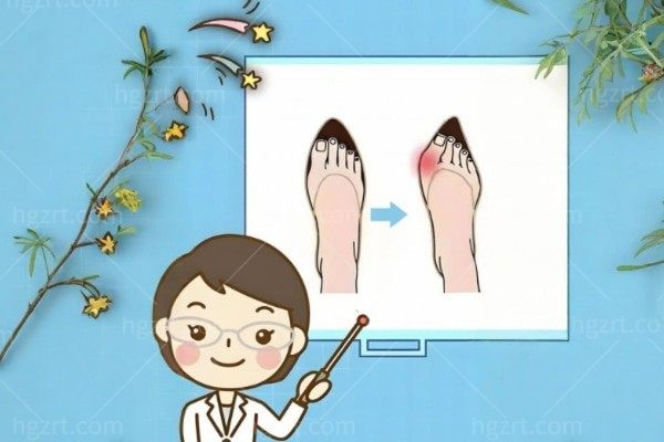 北京苏敬达大脚骨手术在哪个医院?坐诊北京圣嘉新做大脚骨靠谱