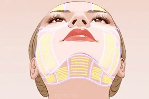 袁博拉皮技术适合哪些人