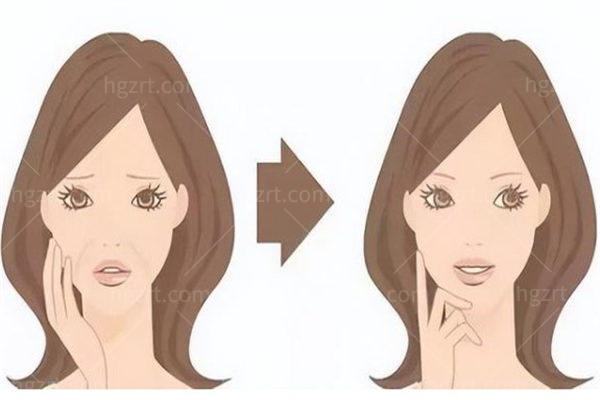 深圳面部拉皮手术哪家做得好