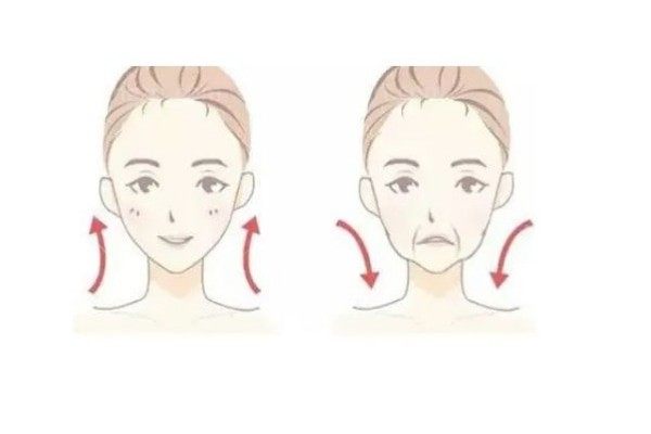 做完面部提升后能维持几年？