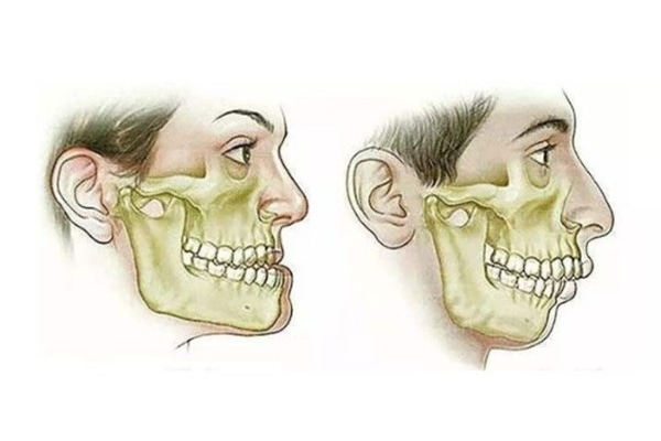 西安正颌手术哪家医院好